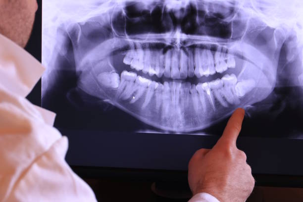 Best Urgent Tooth Repair  in Myerstown, PA