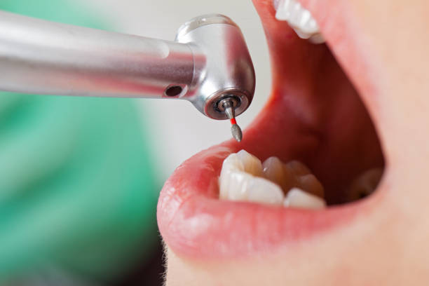 Best Knocked-Out Tooth Emergency  in Myerstown, PA